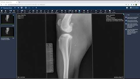 TTA Advancement | Veterinary Image Management Software | Keystone Omni