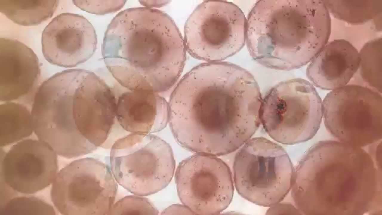 Влияние щелочной воды «Аквалайф» на раковые клетки - YouTube