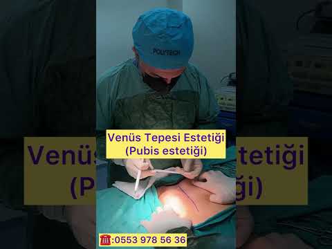 Venüs Tepesi(pubis) Estetiği nasıl yapılır.Puboplasty/Monsplasy by dr hanifi sahin