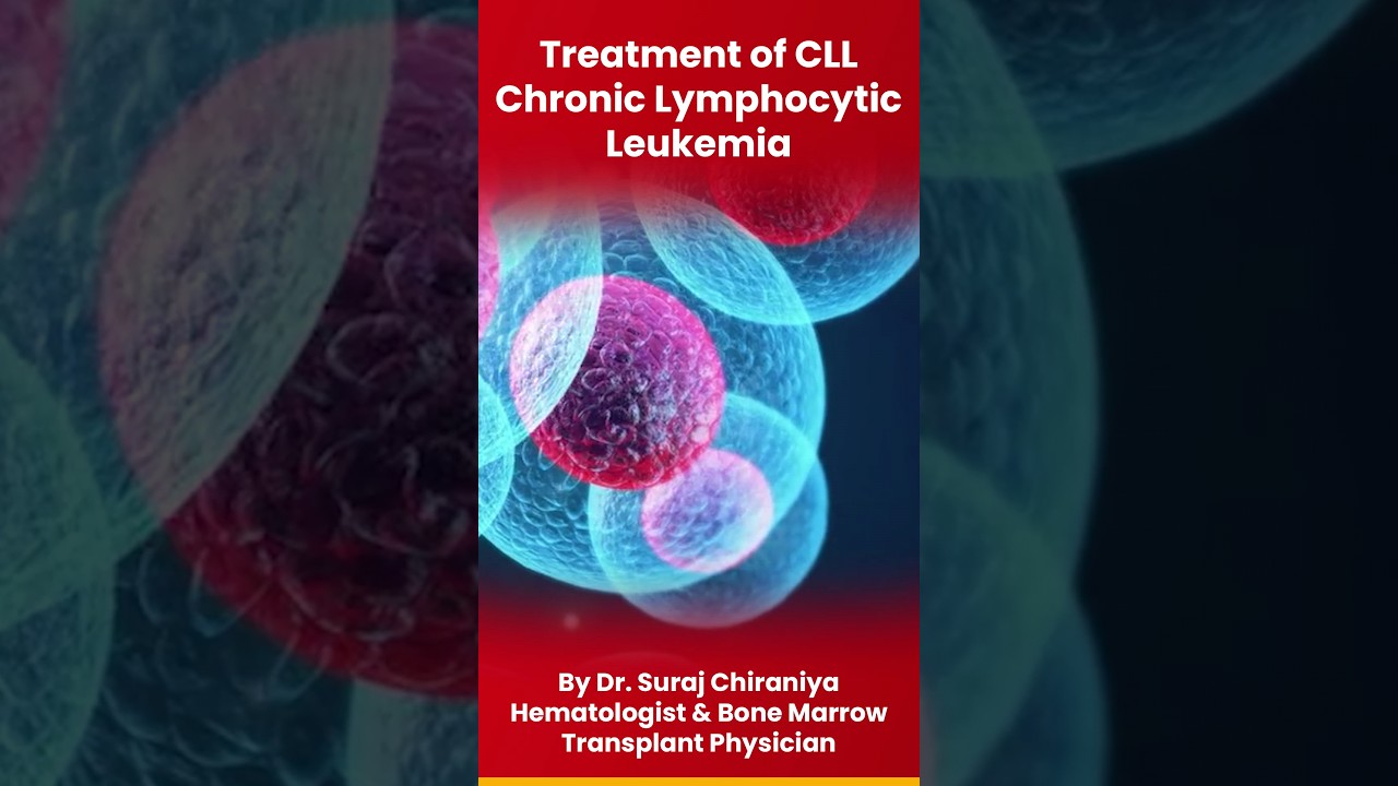Treatment of CLL Chronic Lymphocytic Leukemia by @Dr.SurajChiraniya-Hematologist #leukemia #cancer