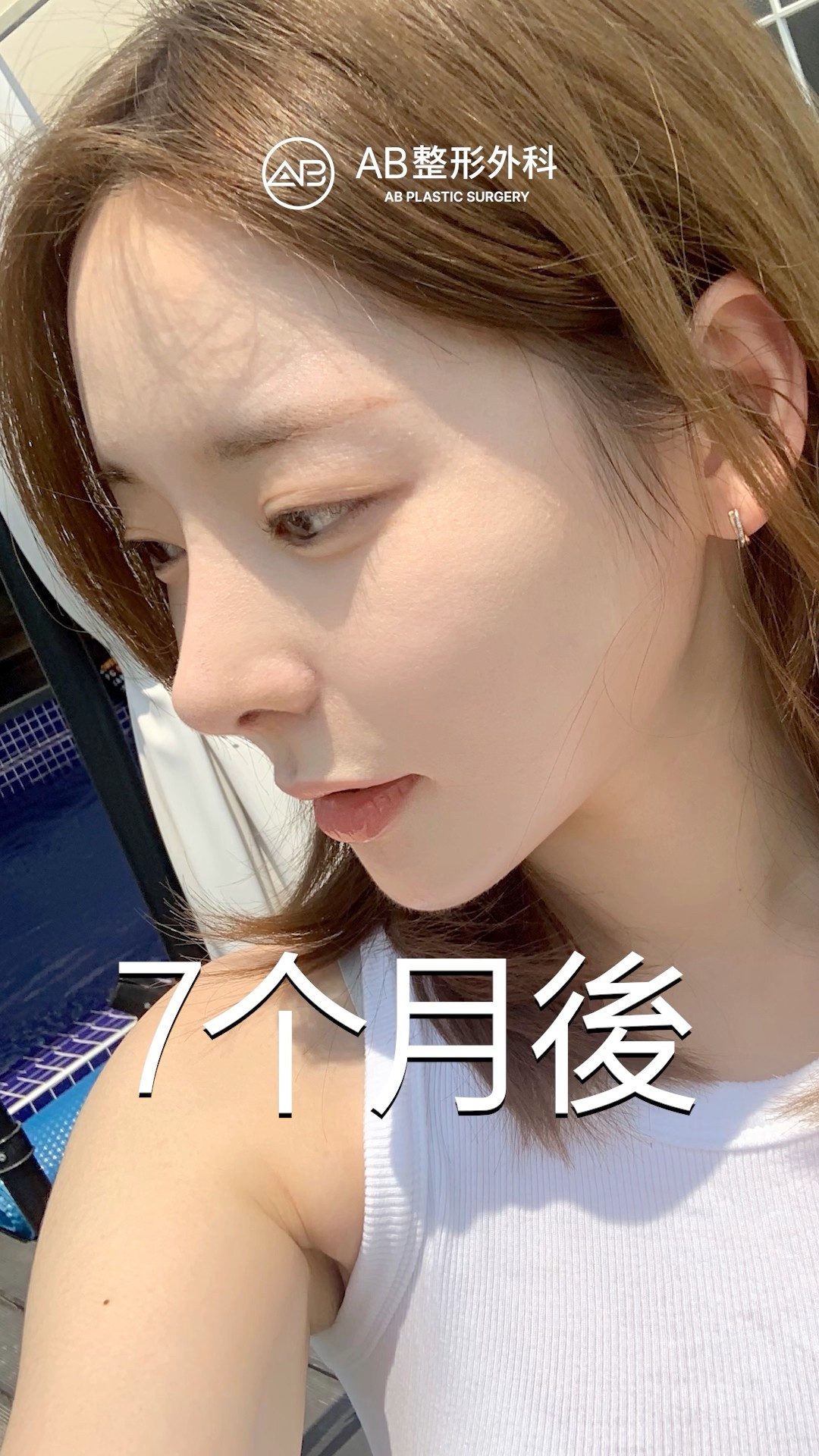 一場眼鼻輪廓的改變，讓人生重啟。 #shorts