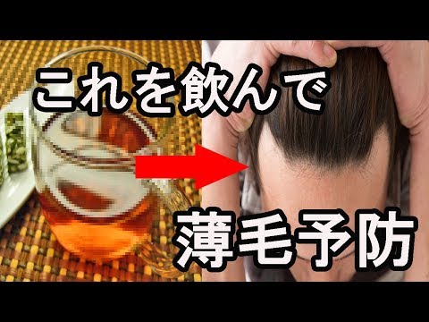 ハゲたくなかったら、これを飲め！薄毛に効く飲み物6選