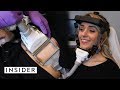 SculpSure | Machine Melts All Your Body Fat featured on Insider