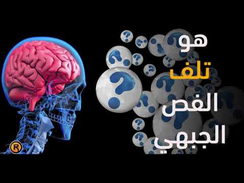 الضحك من دون سبب ليس من قلة الأدب