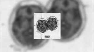 Blanco ft. Nemzzz - Brilliant Mind II (Audio)