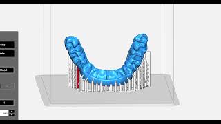 Occlusal Guards - Preparing Occlusal Guards for Print with Keysplint Soft