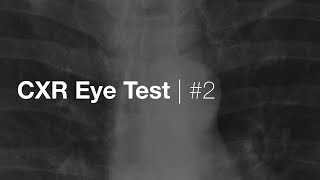 Eye Test