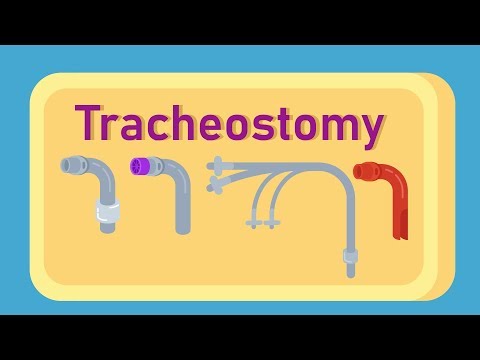 ट्रेकियोस्टोमी क्या है?