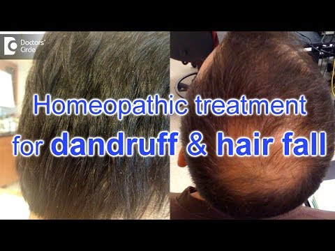 Homeopathic treatment for dandruff and hair fall - Dr. Surekha Tiwari