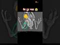 पैर टूट गया #youtubeshorts #armanbadshahkabutar #sadsong #viralshort #sadstatus video