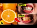 11 Foods You Didn’t Know Are Harming Your Teeth