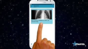 Startel Videos: SM+ Replying to A Message