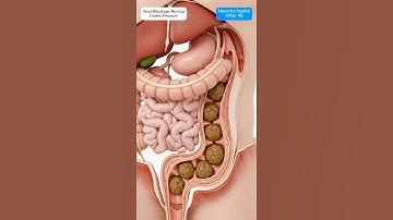 Realistic Colon Animation of Compacted Stool Moving With Intestinal Peristalsis #motivation #shorts