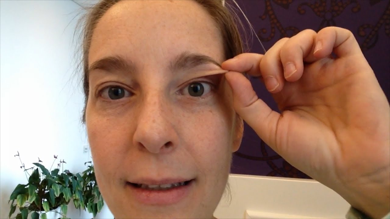 Augenlidstraffung Ohne Op Vor Der Behandlung Besser Als Plasma Pen Erfahrungen Youtube