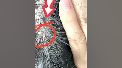 Rết độc cắn chết người - Câu chuyện hài hước có thật | Thỏ thúi tv