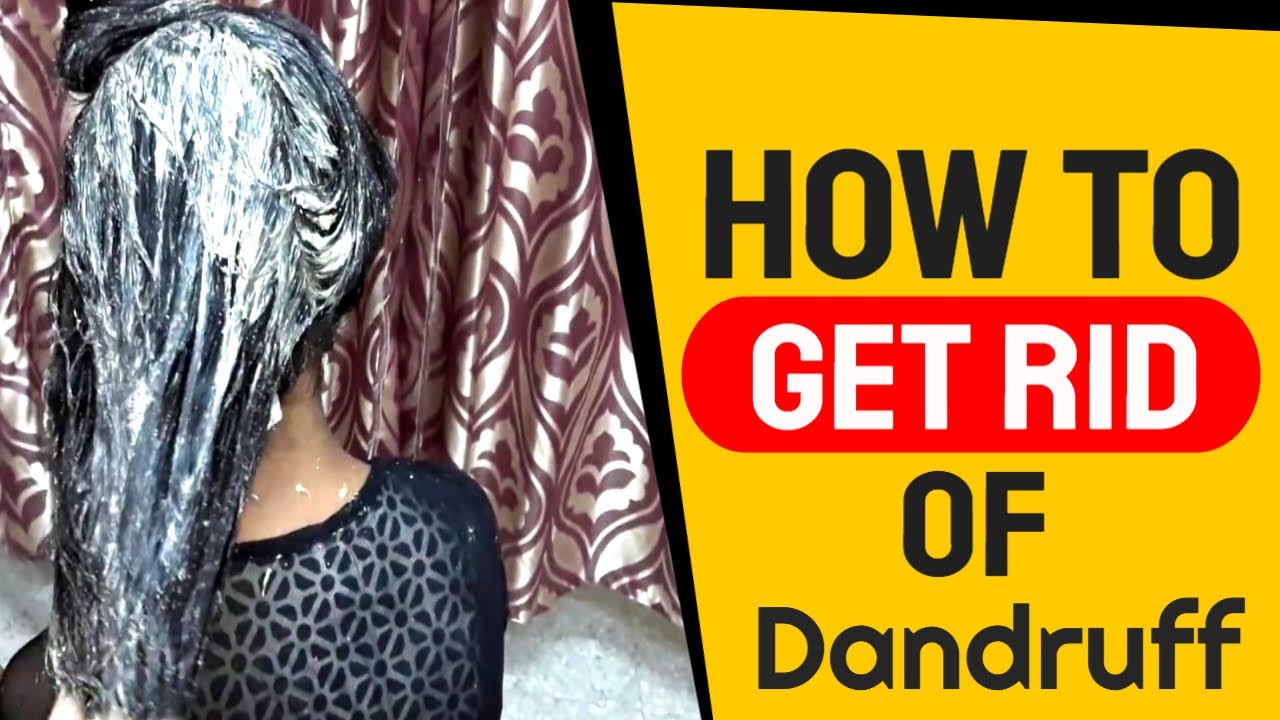 How To Get Rid Of Dandruff At Home DIY Dandruff Remedies For Healthy