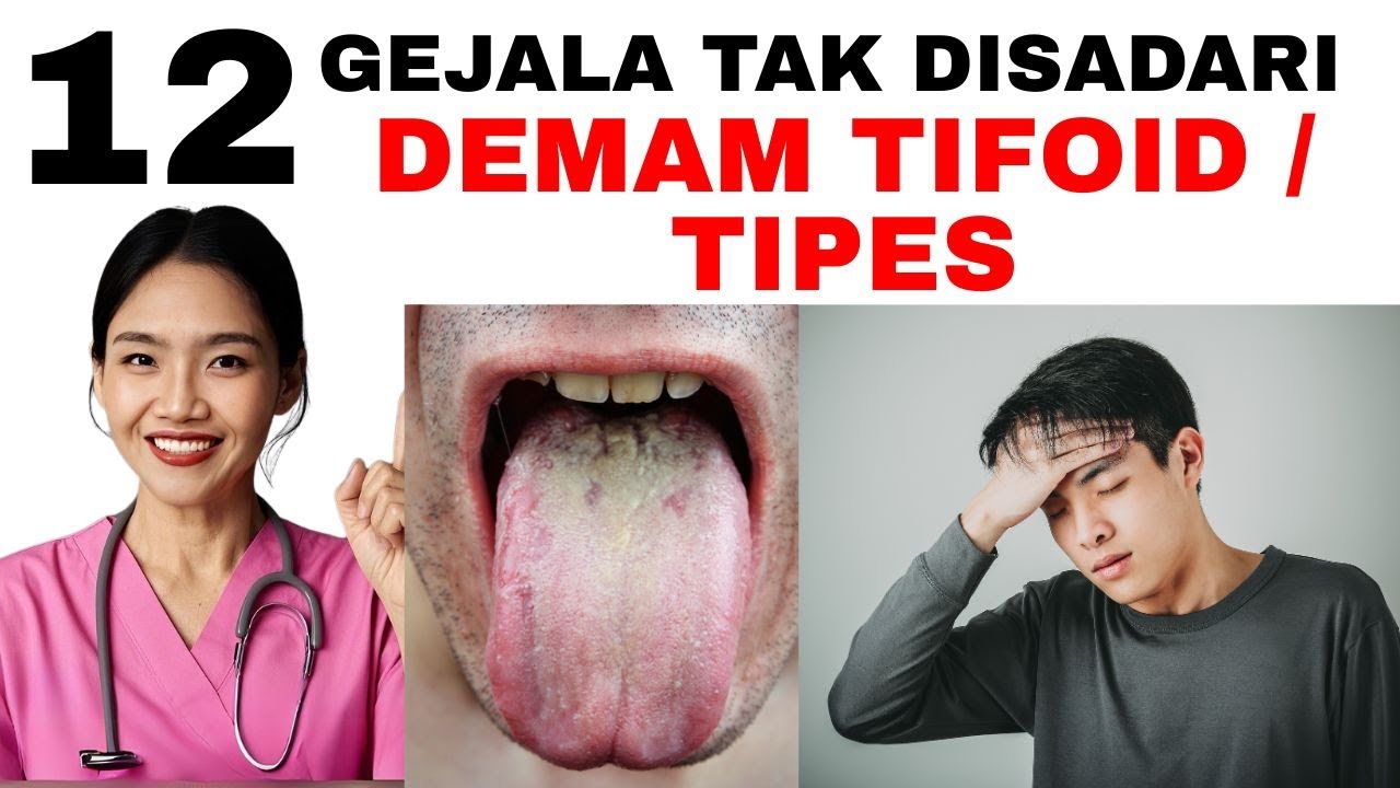 Повышение температуры ночью? Симптомы брюшного тифа и часто пропускаемые тревожные признаки