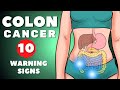 Colon Cancer Symptoms | Colorectal Cancer | 10 warning signs of Colon Cancer | Colon Cancer