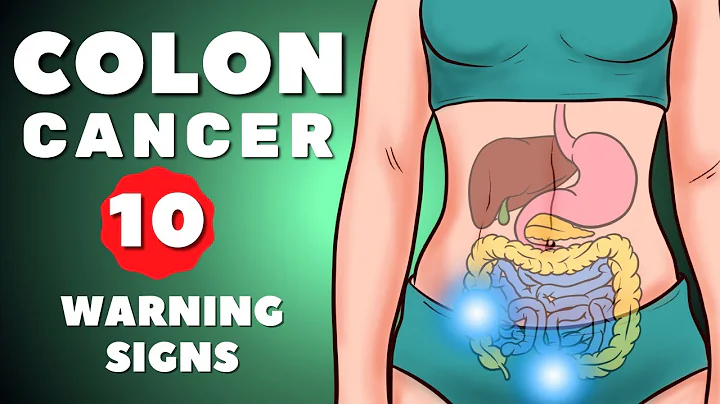 Colon Cancer Symptoms | Colorectal Cancer | 10 warning signs of Colon Cancer | Colon Cancer - DayDayNews