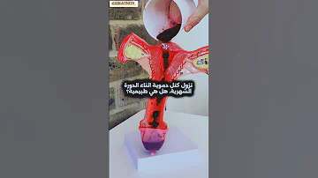 نزول كتل دموية اثناء الدورة الشهرية هل هي طبيعية 