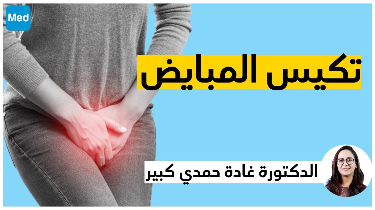 تكيس المبايض / الدكتورة غادة حمدي كبير