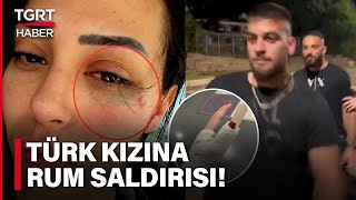 Kıbrıs’ta İnfiale Yol Açan Saldırı! Rumlar Türk Kızı Önce Taciz Sonra Darp Etti! – TGRT Haber