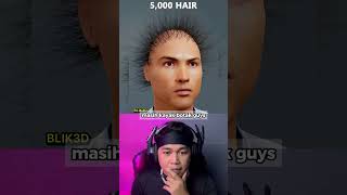 Inilah Ronaldo Versi Botak Sampai 500 Ribu Rambut