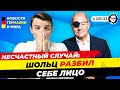 Шольц разбил себе лицо / Бербок разбрасывается деньгами немцев. Новости Германии Миша Бур