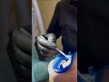 Клиника VALLISTEP,Кострома Отбеливание ZOOM4