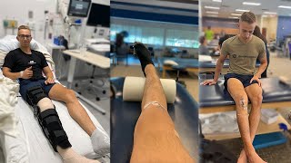 My ACL Surgery Recovery Experience