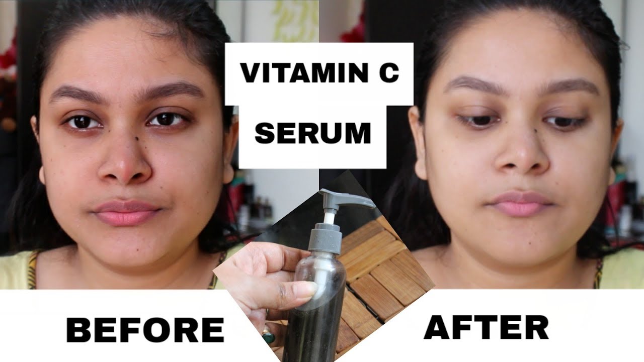 Vitamin C Serum For Bright Clear Spotless Skin Skin Whitening Serum