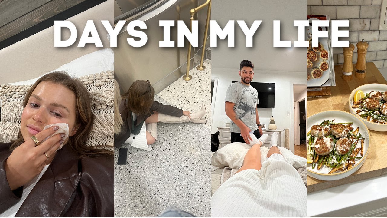 VLOG fracturing my ankle, fancy fries & cutting my hair even shorter
