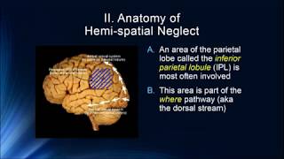Cognition 3 6 Hemispatial Neglect &  Simultagnosia