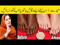 Secret Of How To Make Perfect Face pack | Face Cream for glowing skin Homemade remedy|