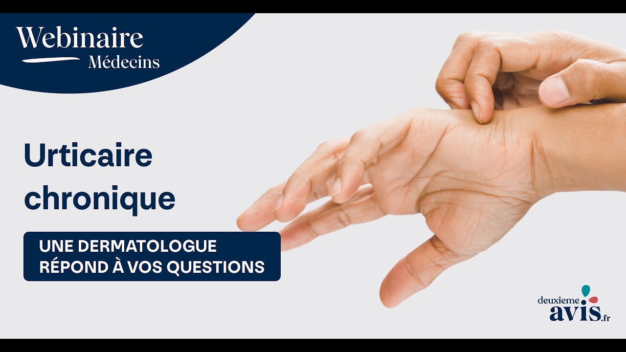 Urticaire chronique : une dermatologue répond à vos questions