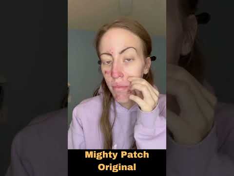 Mighty Patch Original https://amzn.to/3NhxWYb
