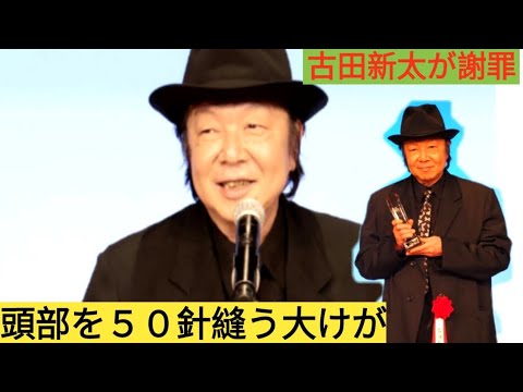 古田新太は10日 前に転倒し、50針縫う重傷を負った。松尾芸能賞授賞式で帽子を被っていたことを謝罪した。,