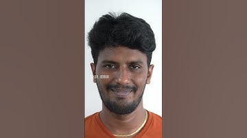 Smile Correction | Dr. Jibran