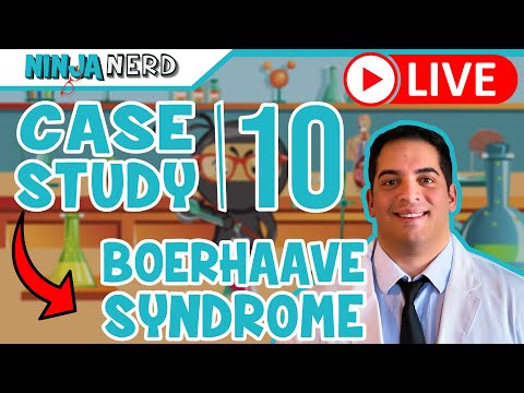 Case Study #10: Boerhaave Syndrome
