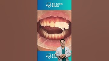 Thay đổi nụ cười trong 30s | Bác sĩ Cường