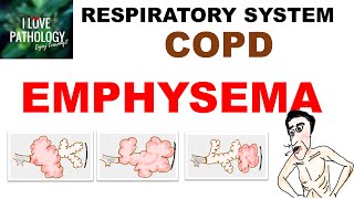 Chronic Obstructive Pulmonary Disease Part 1: Emphysema- Pathology