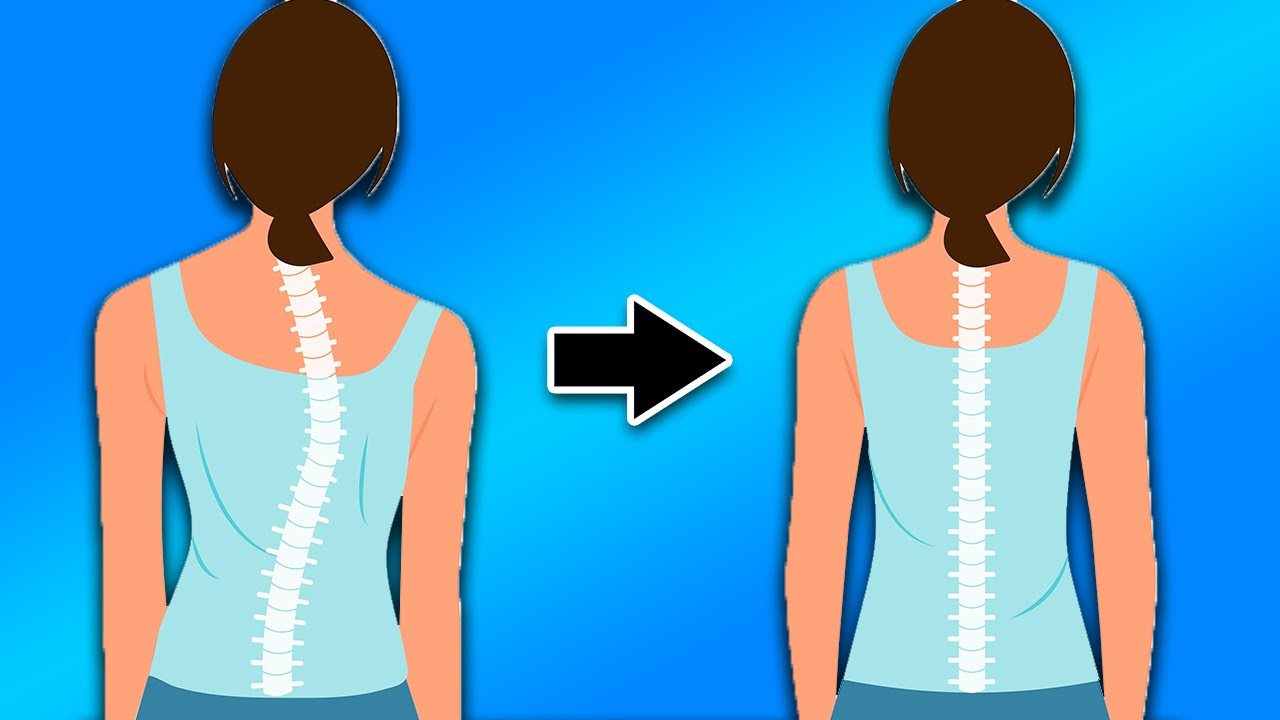 How to Fix Your Posture and Straighten Your Spine