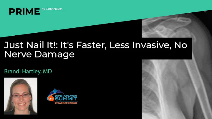 Just Nail It!: It's Faster, Less Invasive, No Nerve Damage - Brandi Hartley, MD