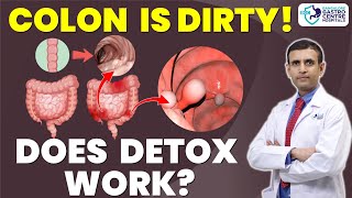 Does Your Colon REALLY Need Detox? Shocking Truth About Gut Cleansing!