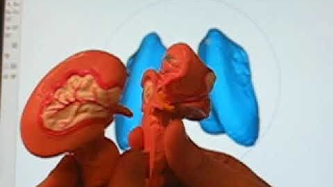 Shape Based Segmentation 0004