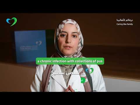 ما الذي يسبب التهاب الغدد العرقية القيحي موجز صحي