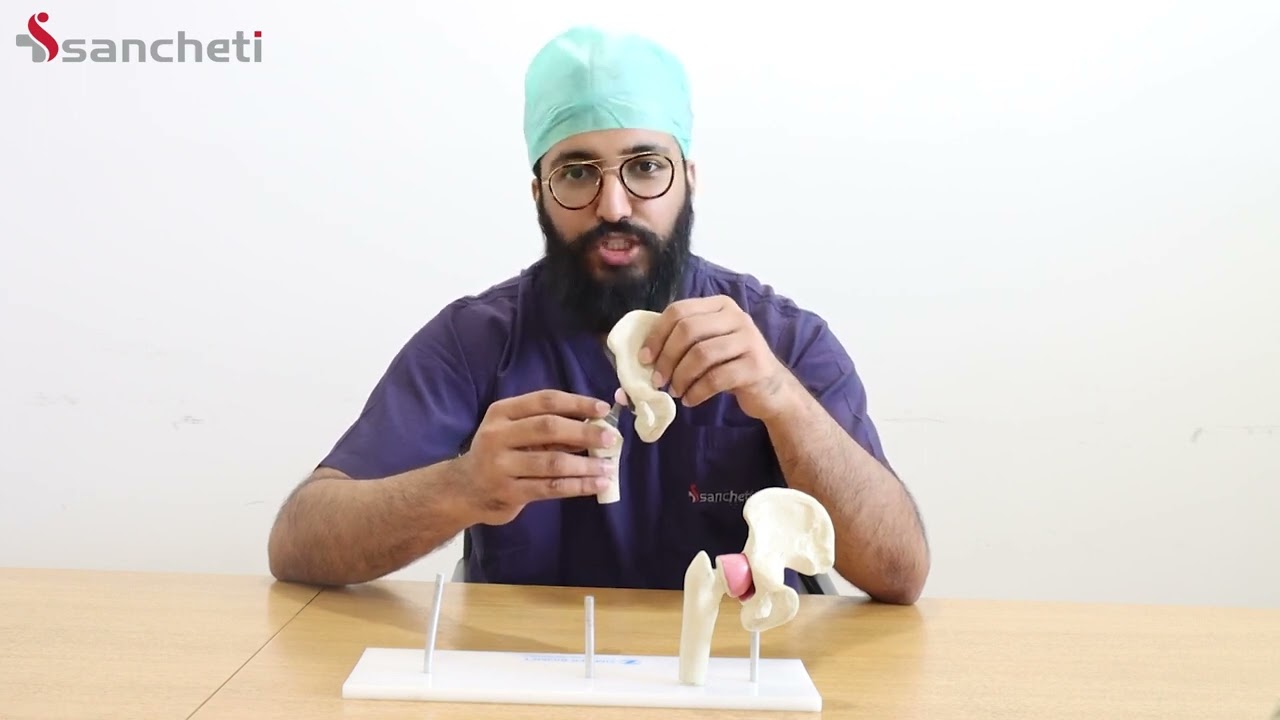 You Won't Believe the HIP Replacement Surgery Secrets Dr. Sahil Sanghavi Reveals