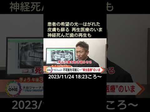【告知】患者の希望の光…はがれた皮膚も蘇る 再生医療のいま 神経死んだ歯の再生も