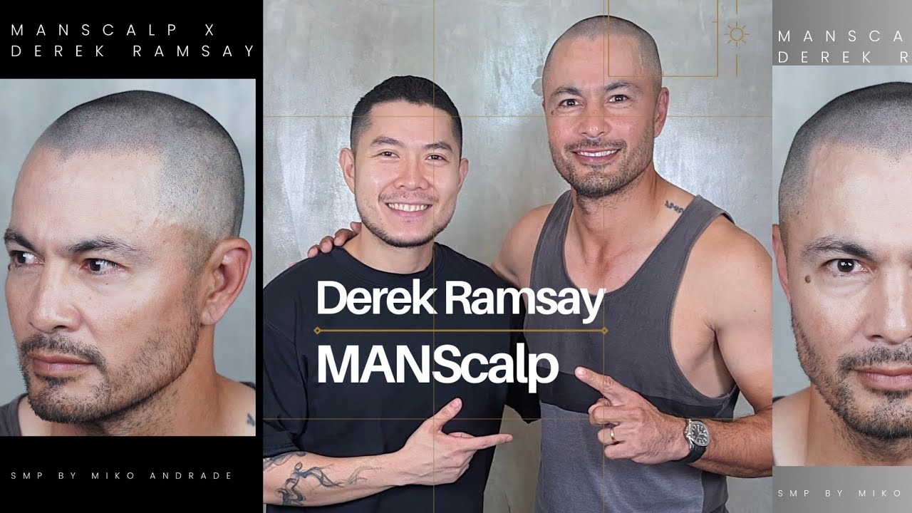 Behind the scenes of Derek's touchup after having Scalp Micropigmentation for 2 years!