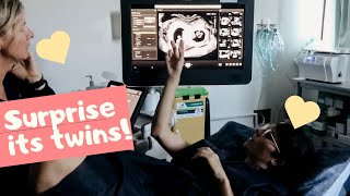 8 week ultrasound SURPRISE TWINS (OUR REACTIONS) by Caileigh 68,848 views 4 years ago 12 minutes, 6 seconds